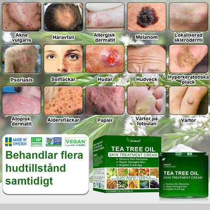 🌿𝐳𝐯𝐨𝐞𝐯𝐨® 𝐓𝐞𝐚 𝐓𝐫𝐞𝐞-𝐨𝐥𝐣𝐚 𝐇𝐮𝐝𝐛𝐞𝐡𝐚𝐧𝐝𝐥𝐢𝐧𝐠𝐬𝐤𝐫𝐚̈𝐦