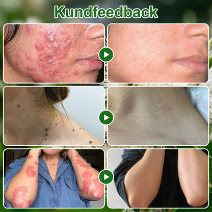 🌿𝐳𝐯𝐨𝐞𝐯𝐨® 𝐓𝐞𝐚 𝐓𝐫𝐞𝐞-𝐨𝐥𝐣𝐚 𝐇𝐮𝐝𝐛𝐞𝐡𝐚𝐧𝐝𝐥𝐢𝐧𝐠𝐬𝐤𝐫𝐚̈𝐦