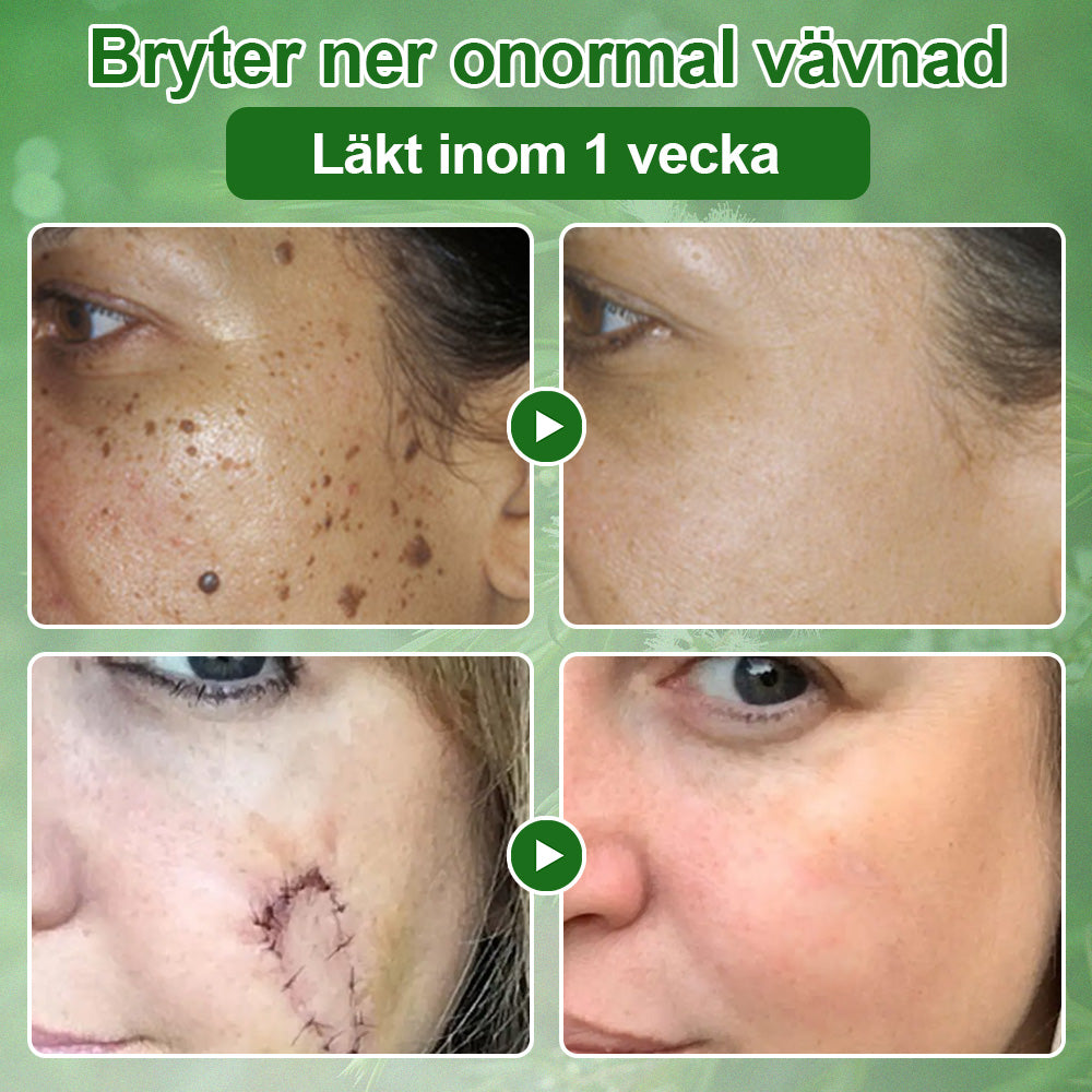 🌿𝐳𝐯𝐨𝐞𝐯𝐨® 𝐓𝐞𝐚 𝐓𝐫𝐞𝐞-𝐨𝐥𝐣𝐚 𝐇𝐮𝐝𝐛𝐞𝐡𝐚𝐧𝐝𝐥𝐢𝐧𝐠𝐬𝐤𝐫𝐚̈𝐦