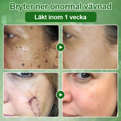 🌿𝐳𝐯𝐨𝐞𝐯𝐨® 𝐓𝐞𝐚 𝐓𝐫𝐞𝐞-𝐨𝐥𝐣𝐚 𝐇𝐮𝐝𝐛𝐞𝐡𝐚𝐧𝐝𝐥𝐢𝐧𝐠𝐬𝐤𝐫𝐚̈𝐦