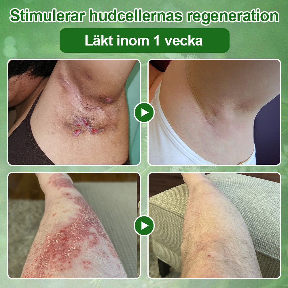 🌿𝐳𝐯𝐨𝐞𝐯𝐨® 𝐓𝐞𝐚 𝐓𝐫𝐞𝐞-𝐨𝐥𝐣𝐚 𝐇𝐮𝐝𝐛𝐞𝐡𝐚𝐧𝐝𝐥𝐢𝐧𝐠𝐬𝐤𝐫𝐚̈𝐦