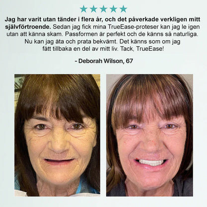 🦷𝗕𝗶𝗸𝗲𝗻𝗱𝗮® 𝗔𝗱𝘃𝗮𝗻𝗰𝗲𝗱 𝗞𝗹𝗮𝗱𝗱𝗳𝗿𝗲𝗱𝗶𝗴 𝗙𝘂𝗹𝗹𝗮 𝗧𝗲𝗻𝗱𝗲𝗻𝘁𝗮𝗿 𝗦𝗲𝘁 （✅ Kliniskt beprövade bekväma proteser ）